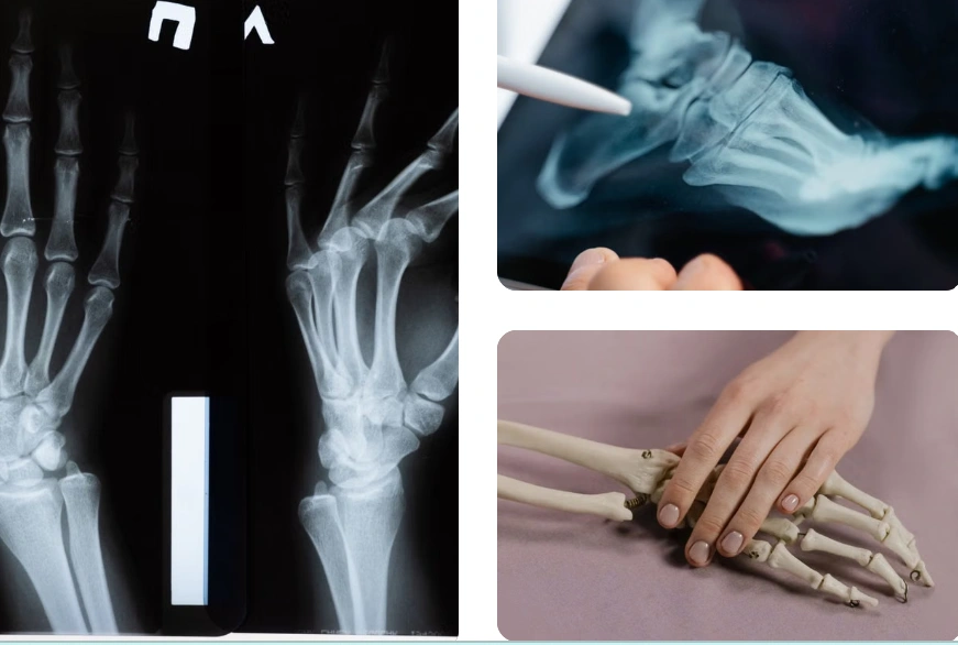 bone and bleeding risks climb with age