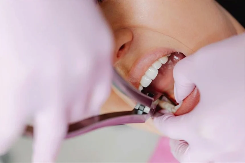 is gingivitis contagious