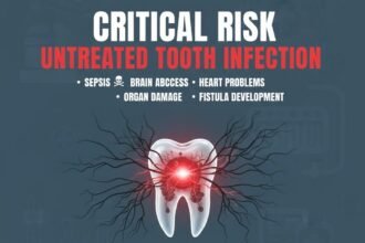 Critical Risk of an Untreated Tooth Infection