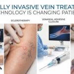 Minimally Invasive Vein Treatments: How Technology Is Changing Patient Care
