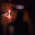 Advancements in Eye Care Procedures Enhancing Long-Term Visual Clarity
