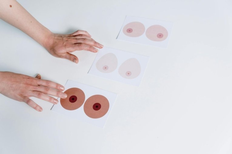 How Breast Augmentation Costs Vary by Style, Size, and Trends