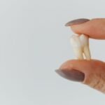 Simple Ways to Reduce Swelling After Wisdom Teeth Removal