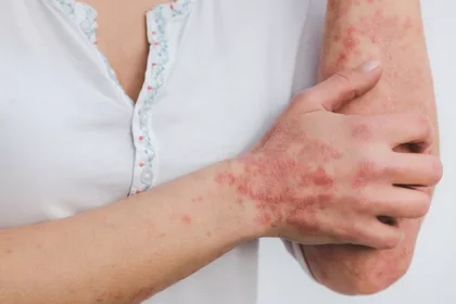 The Effects of Addiction on Your Skin