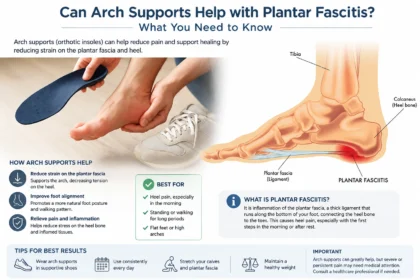 Can Arch Supports Help with Plantar Fasciitis
