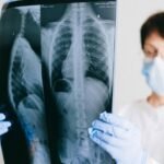 How to Cope With an Asbestos-Related Lung Cancer Diagnosis