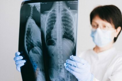 How to Cope With an Asbestos-Related Lung Cancer Diagnosis