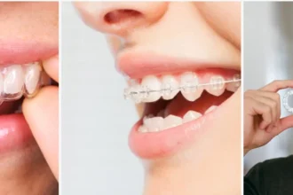 Teeth Aligners Let’s Break Them into Simple Truths!